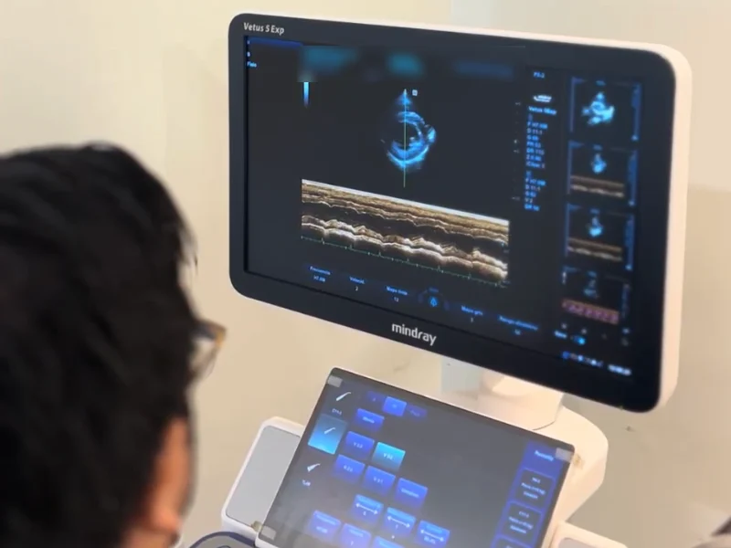 Ecocardiograma en modo M en el monitor del ecógrafo de Lomont®, estudio con el que el cardiólogo evalúa el movimiento de las paredes y las válvulas del corazón