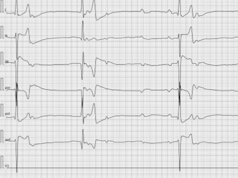 Trazo de electrocardiograma veterinario de Lomont®, estudio que registra la actividad eléctrica del corazón para identificar arritmias
