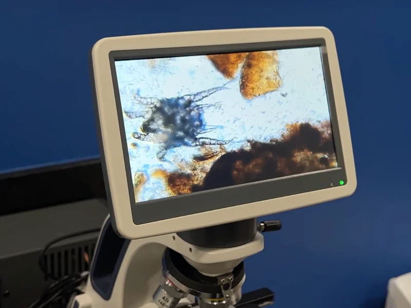 Raspado cutáneo observado en el microscopio con pantalla de Lomont®: en la imagen se aprecia un ácaro, uno de los parásitos externos que se identifican en la valoración dermatológica