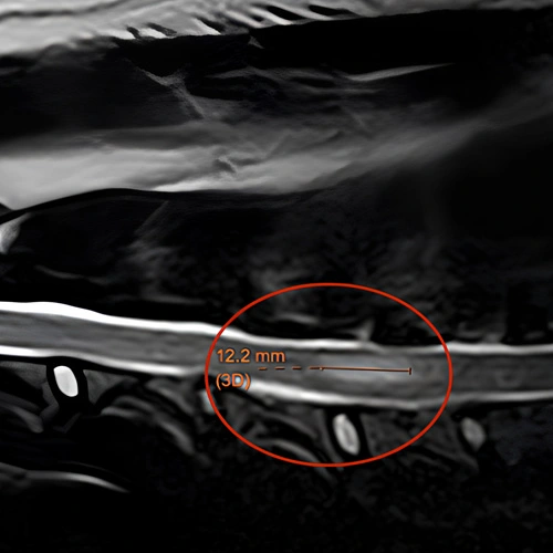 Neurología veterinaria Lomont